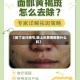 【欧了出行限号,脸上长黄褐斑看什么科】
